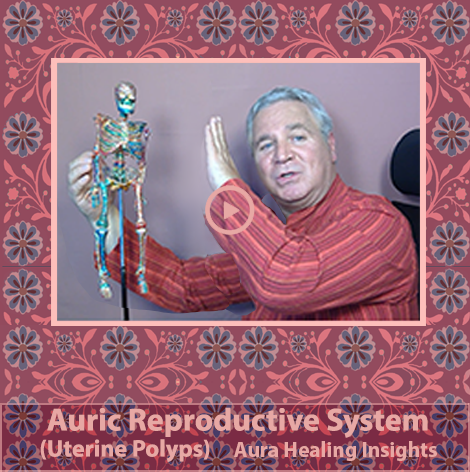Auric Reproductive System - Urinary Polyps