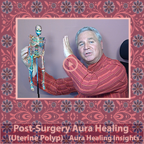 Post-Surgery Aura Healing - Uterine Polyp